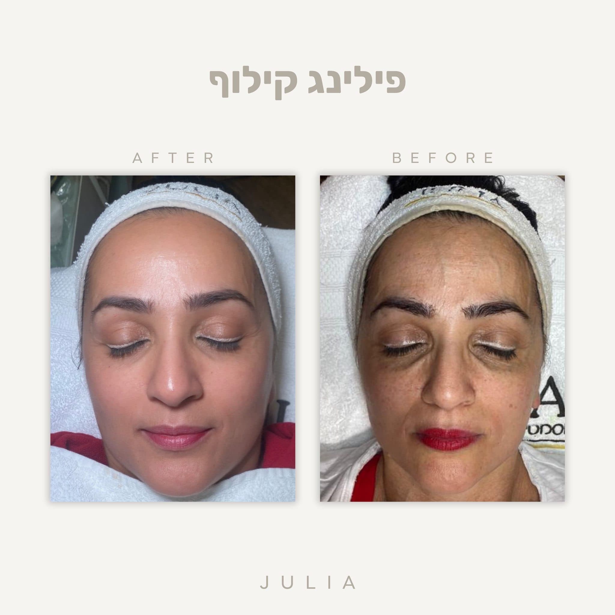 טיפולי פנים משקמים — ג׳וליה קוסמטיקס בראשון לציון